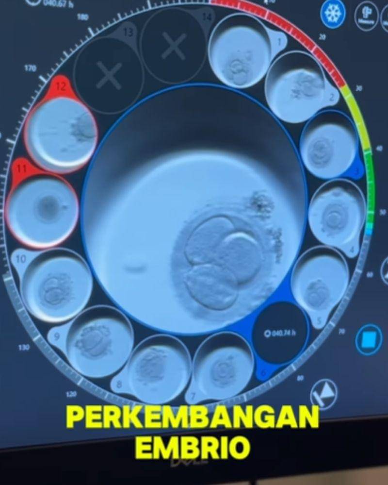 Instagram.com/sumargodenny